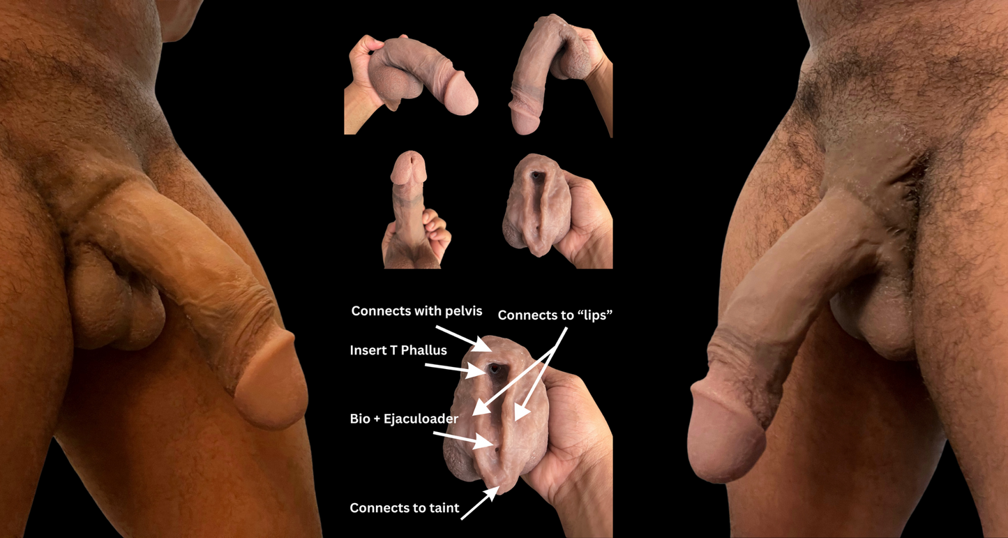 Attachment Kits